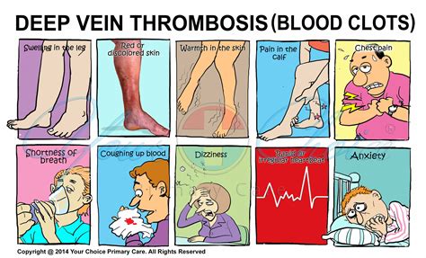 clotsiti|Thrombosis: Symptoms & Treatment .
